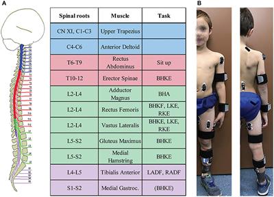 Muscle Activation Patterns During Movement Attempts in Children With Acquired Spinal Cord Injury: Neurophysiological Assessment of Residual Motor Function Below the Level of Lesion